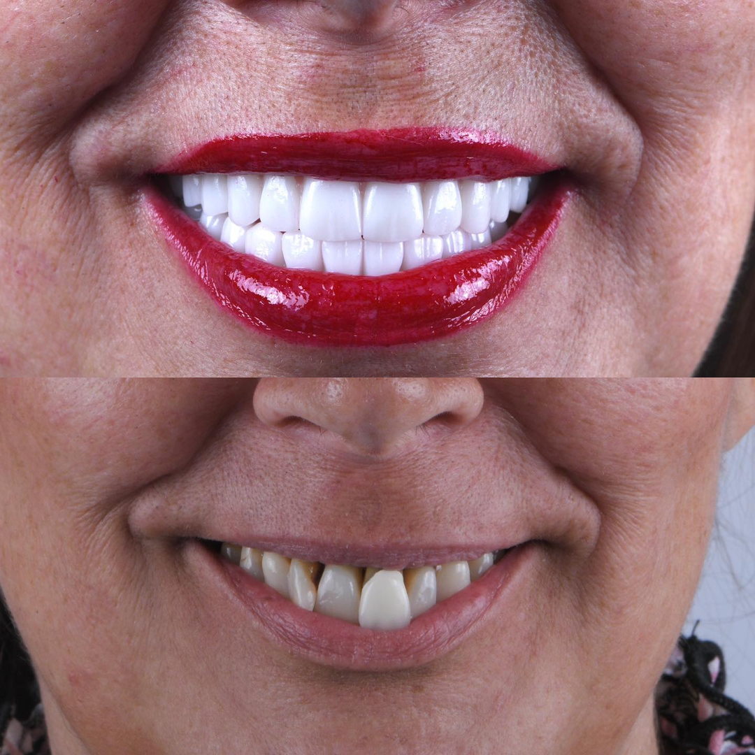 SmileCentric - Cosmetic Dentist / Dental Implant Center Image