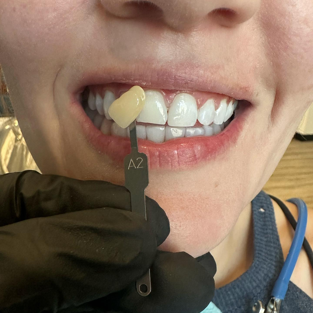 SmileCentric - Cosmetic Dentist / Dental Implant Center Image