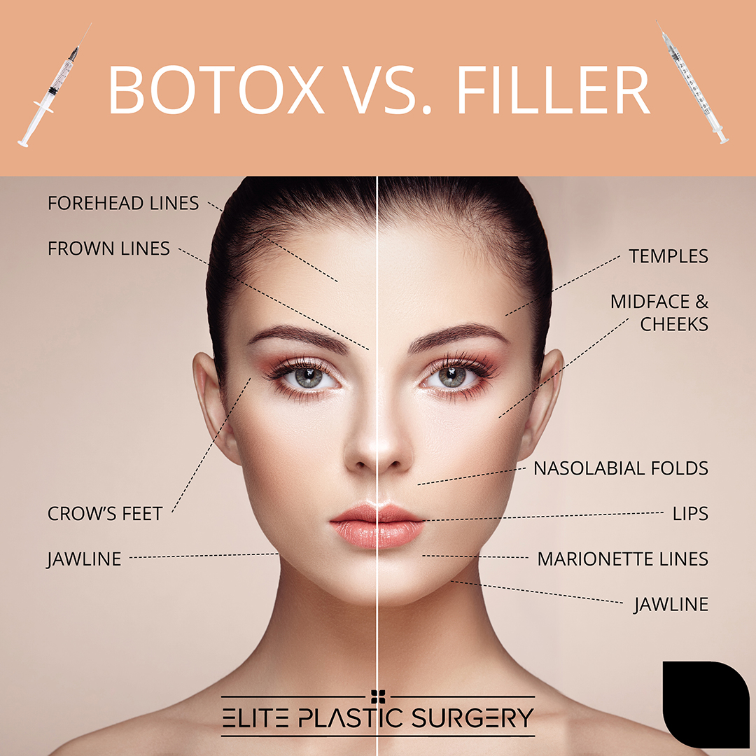 Elite Plastic Surgery - Chandler AZ Image