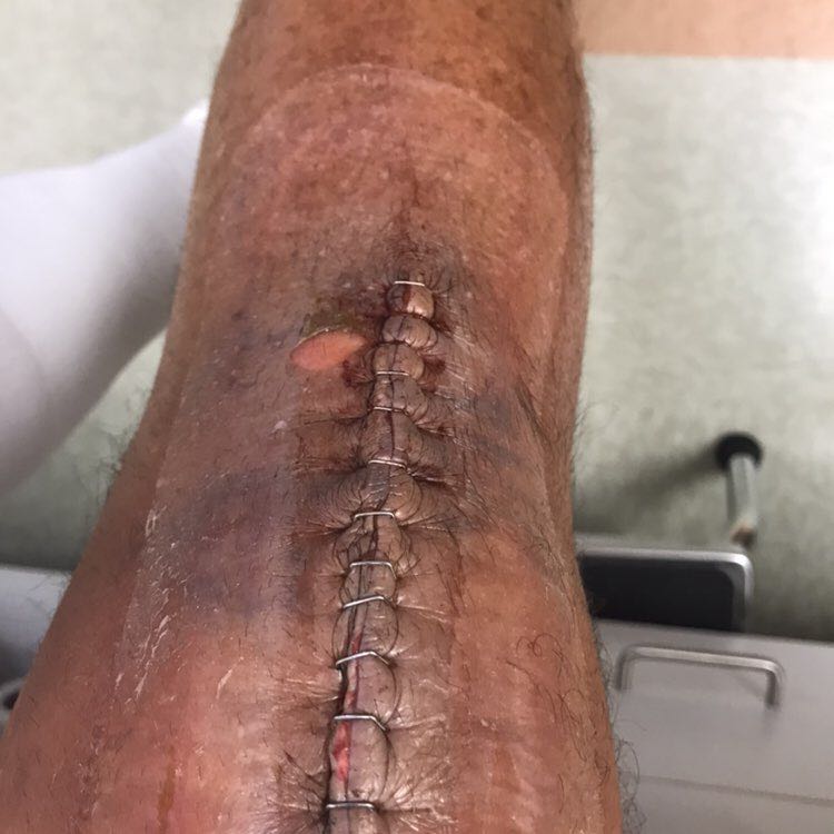 PacerGuy_1950s post 1