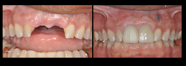 3 Before and And After 3 Before and And After