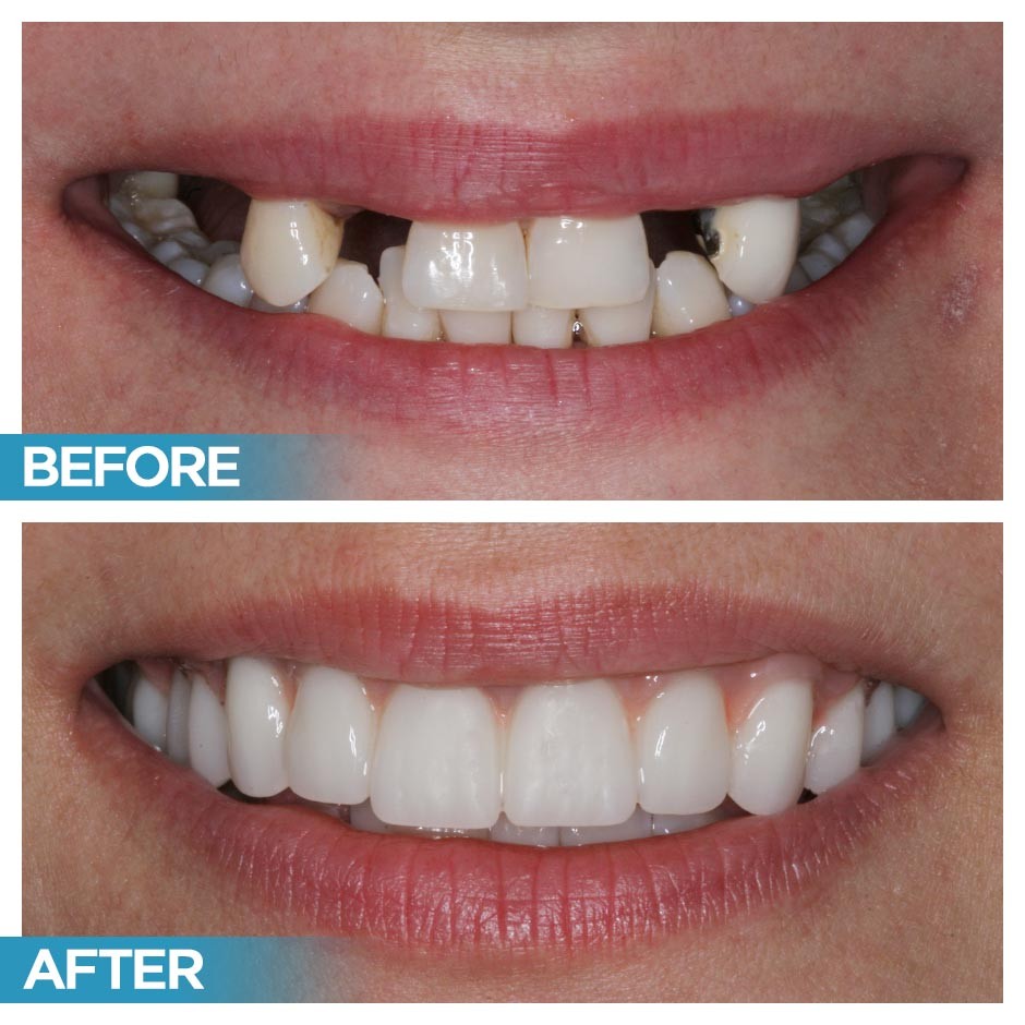 6 Before and And After 6 Before and And After
