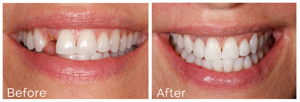 8 Before and And After 8 Before and And After