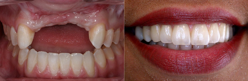 25 Several Before and And After 25 Several Before and And After