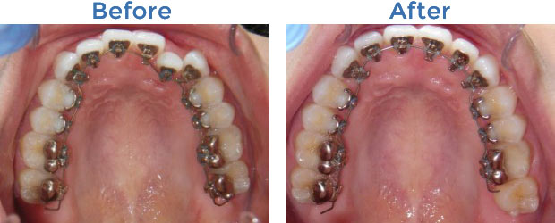 Case-2-Composite Case-2-Composite