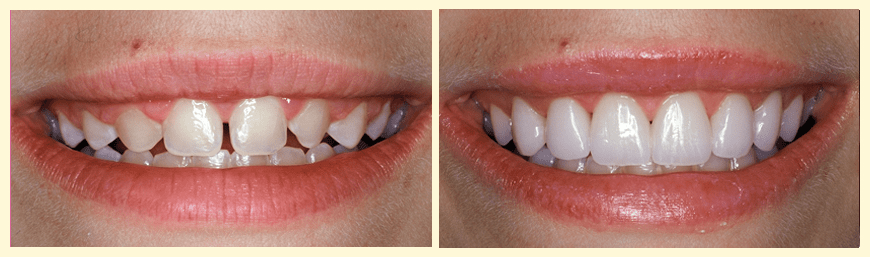 1 before-and-after 1 before-and-after