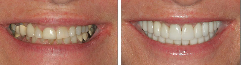 14 before-and-after 14 before-and-after