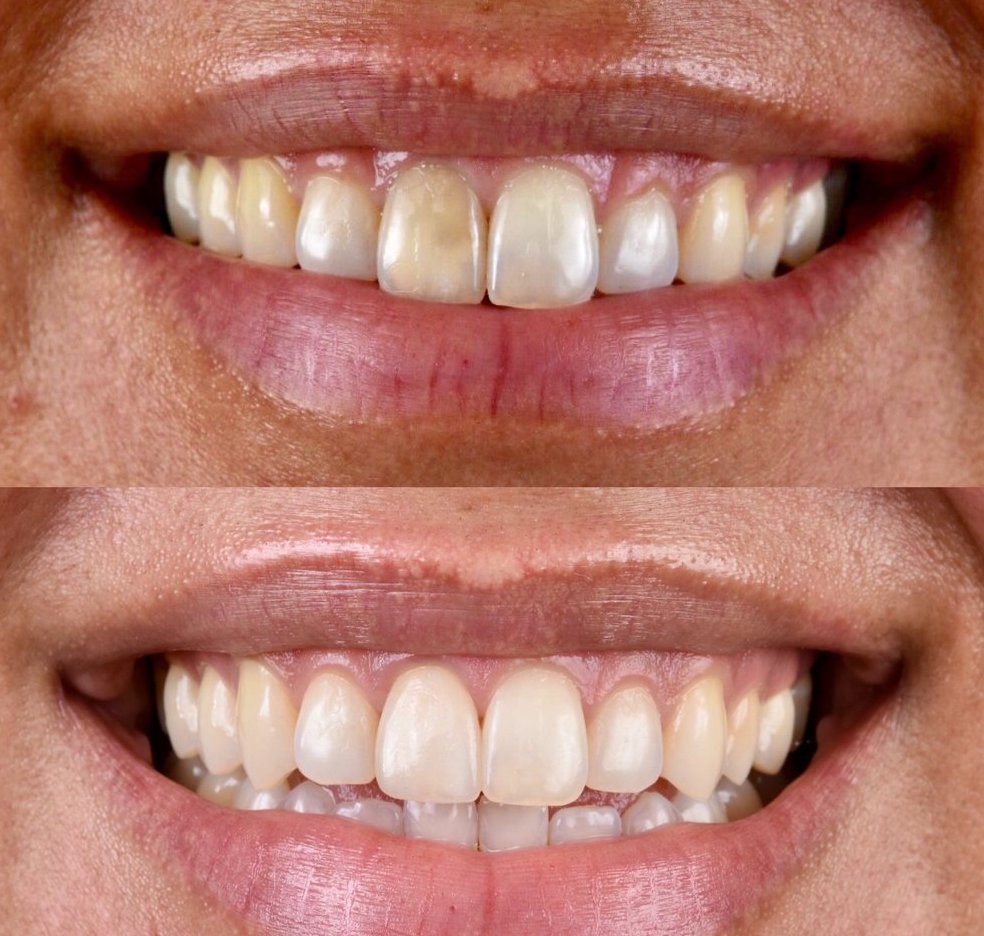 12 before-and-after 12 before-and-after