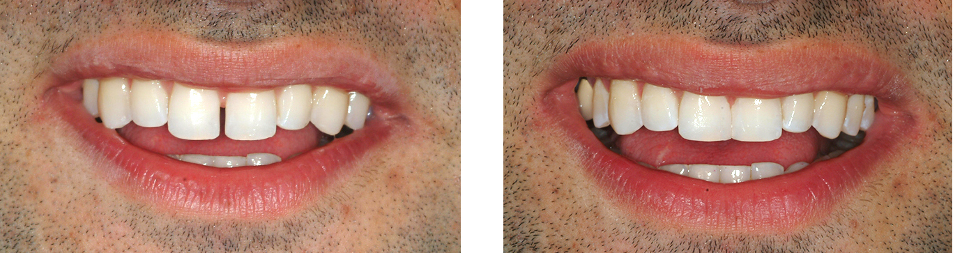 3 before-and-after 3 before-and-after