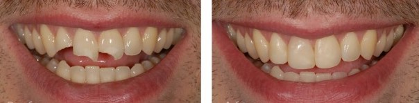 5 before-and-after 5 before-and-after