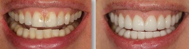 6 before-and-after 6 before-and-after