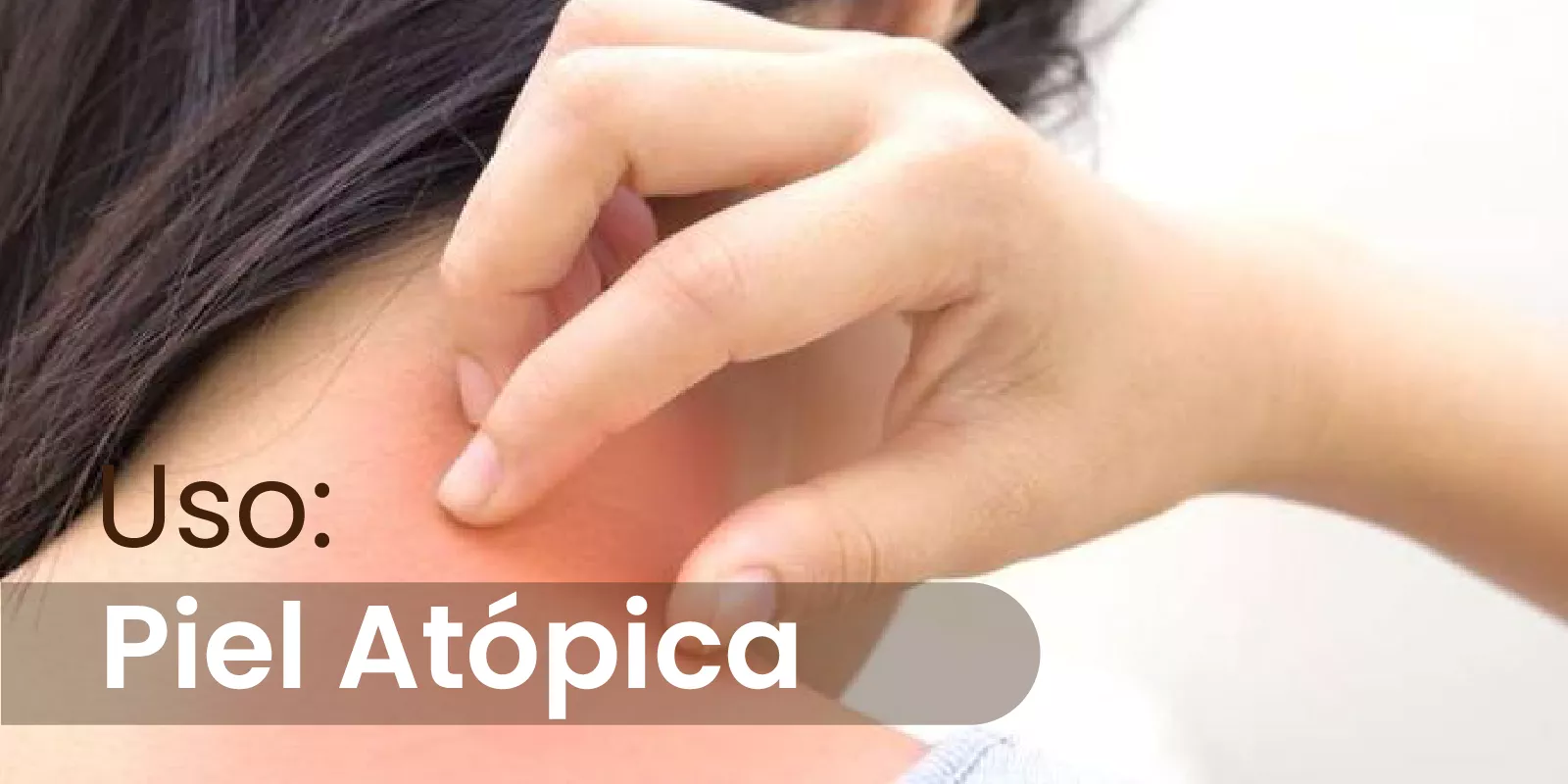 Uso: Piel Atópica