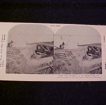 Stereograph