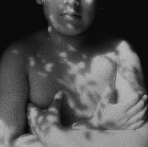 Irwin with his arm folded