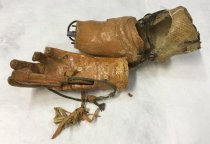 Arm and Detachable Wrist Prosthesis