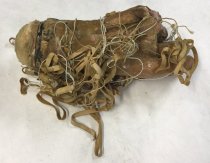 Detached Hand Prosthesis