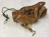 Detached Hand Prosthesis