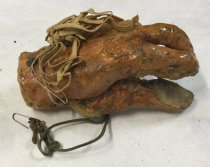 Detached Hand Prosthesis