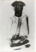 X-Ray Pedro Mountain Mummy