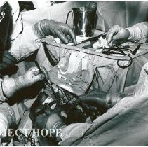 Dr. Stevenson, our neurosurgeon.