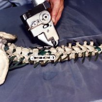 Back surgery tool demonstration