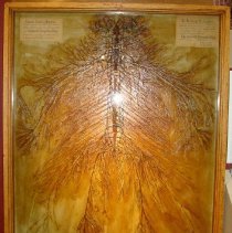 Dissected Nervous System