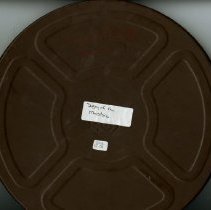 Film Reel Surgery of Mastoid