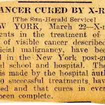 Cancer Cured by X-Ray