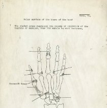 Diagram of the Volar Surface of the Hand Bones