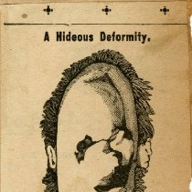 A Hideous Deformity