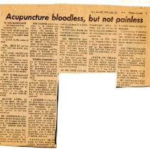 Acupuncture Bloodless, But Not Painless