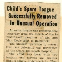 Child’s Spare Tongue Successfully Removed in Unusual Operation