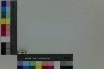 Gold colored metal bottom teeth grillz