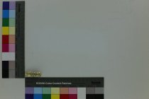 Gold colored metal top teeth grillz