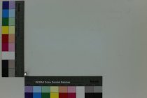 Silver colored metal tooth cap