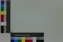 Gold colored metal tooth cap