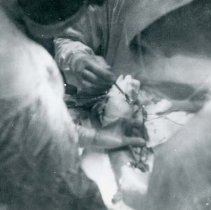 Surgery In A Military Hospital; Philippine Islands; World War 2