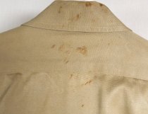 Outside Collar Stains