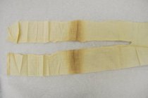 Bandage (unfolded, left)