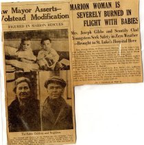 Marion Woman Is Severely Burned