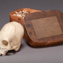 Deformed Skull, with box