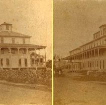 Stereograph