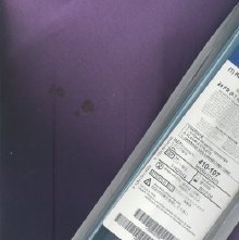 Catheters, Nephrostomy