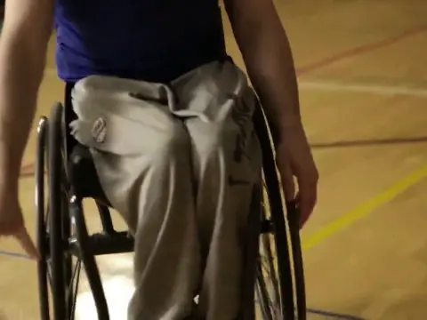 Spinal Bifida