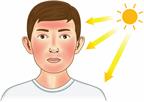 Sunburn on a person's face.