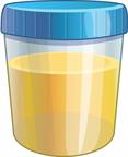 A sample cup that contains urine.