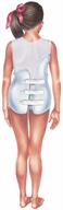 A person facing backwards wearing a back brace.