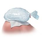 Bag of ice on a towel on the skin.