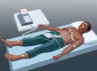A person lying down with sticky patches on their chest, arms, and legs. Wires run from the patches to a machine.
