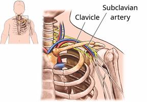 The shoulder area, showing the top ribs, the clavicle, and the subclavian artery.